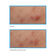 BLEMISH RAPID RELIEF SPOT TREATMENT 15ML